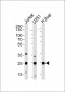 GSTM1 Antibody (C-term)